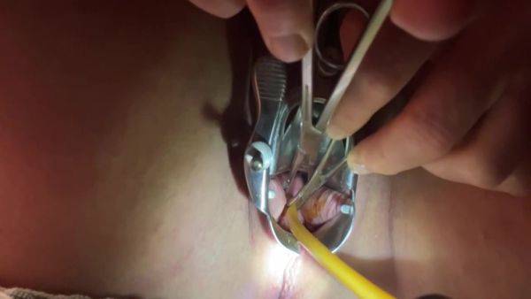 Tenaculum Grasping Cervix For Catheter 7 Min - hclips.com on systemporn.com